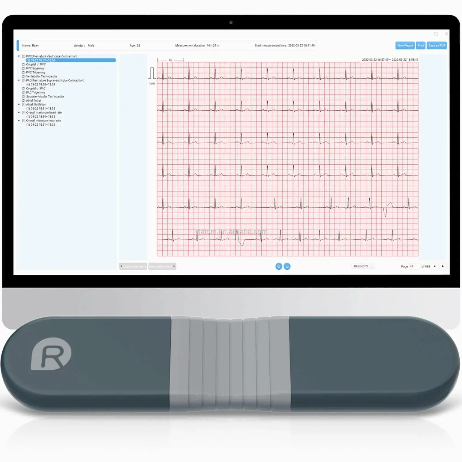 Wireless Bluetooth Dynamic Rec – Ecg Patch Monitor recenzja i cena